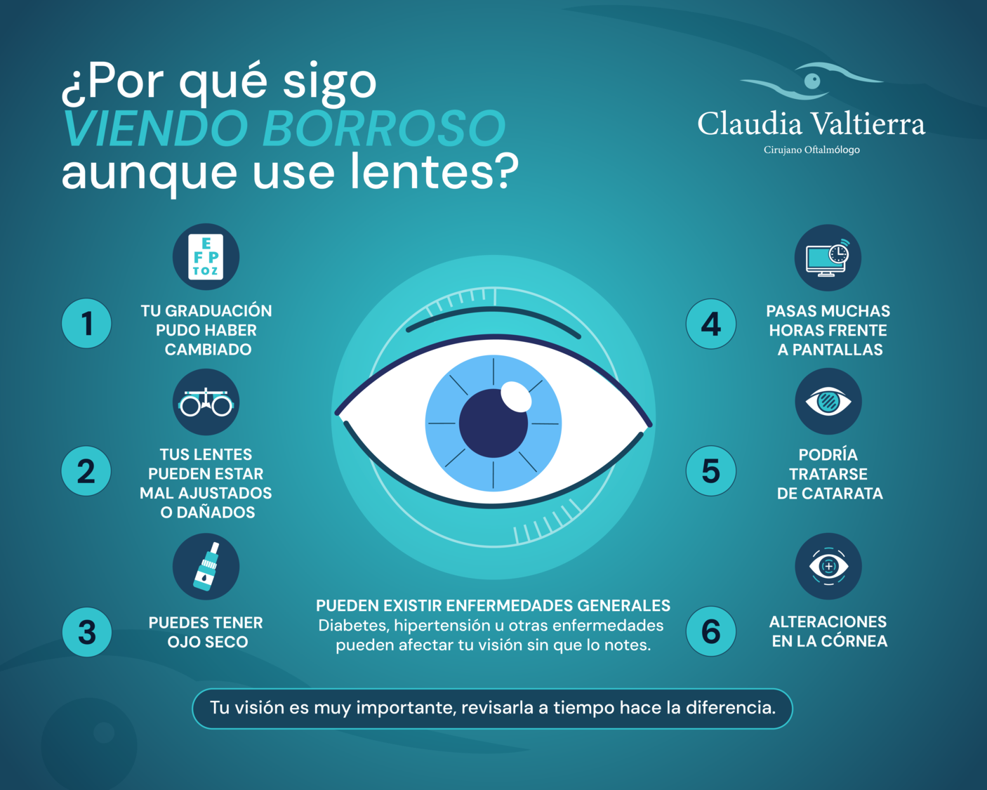 ¿Por qué veo borroso aunque use lentes?